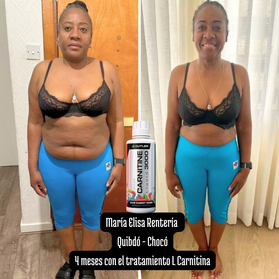 Tratamiento quema grasa - L Carnitine 3000 - Resultados visibles en tu cuerpo