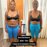 Tratamiento quema grasa - L Carnitine 3000 - Resultados visibles en tu cuerpo