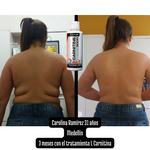 Tratamiento quema grasa - L Carnitine 3000 - Resultados visibles en tu cuerpo