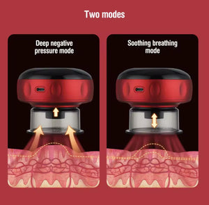 Smart Cupping Pro - Combate la Celulitis - VENTOSA - MASAJEADOR