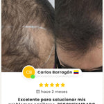 DHT BLOCKER 60 Capsulas - Actúa ahora antes de que la caída de tu cabello avance.