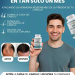 DHT BLOCKER 60 Capsulas - Actúa ahora antes de que la caída de tu cabello avance.
