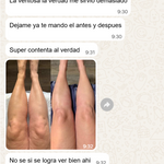 SMART CUPPING PRO™ Masajeador Inteligente de Bienestar y Cuidado Corporal