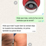 SMART CUPPING PRO™ Masajeador Inteligente de Bienestar y Cuidado Corporal