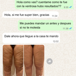 SMART CUPPING PRO™ Masajeador Inteligente de Bienestar y Cuidado Corporal